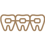 表側矯正（ワイヤー矯正）