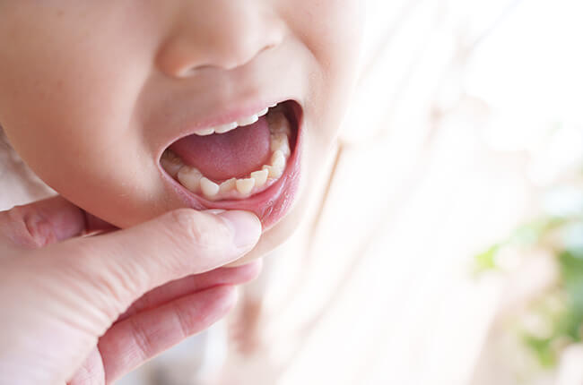 子どもの歯並びが気になる
